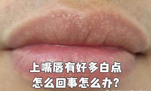 月经期间适合做体检吗-月经期间可以体检吗、月经期间可以体检吗 -例假期间是否适合做体检网